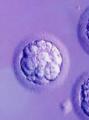 Имплантация эмбриона: основные симптомы и ощущения после прикрепления плодного яйца